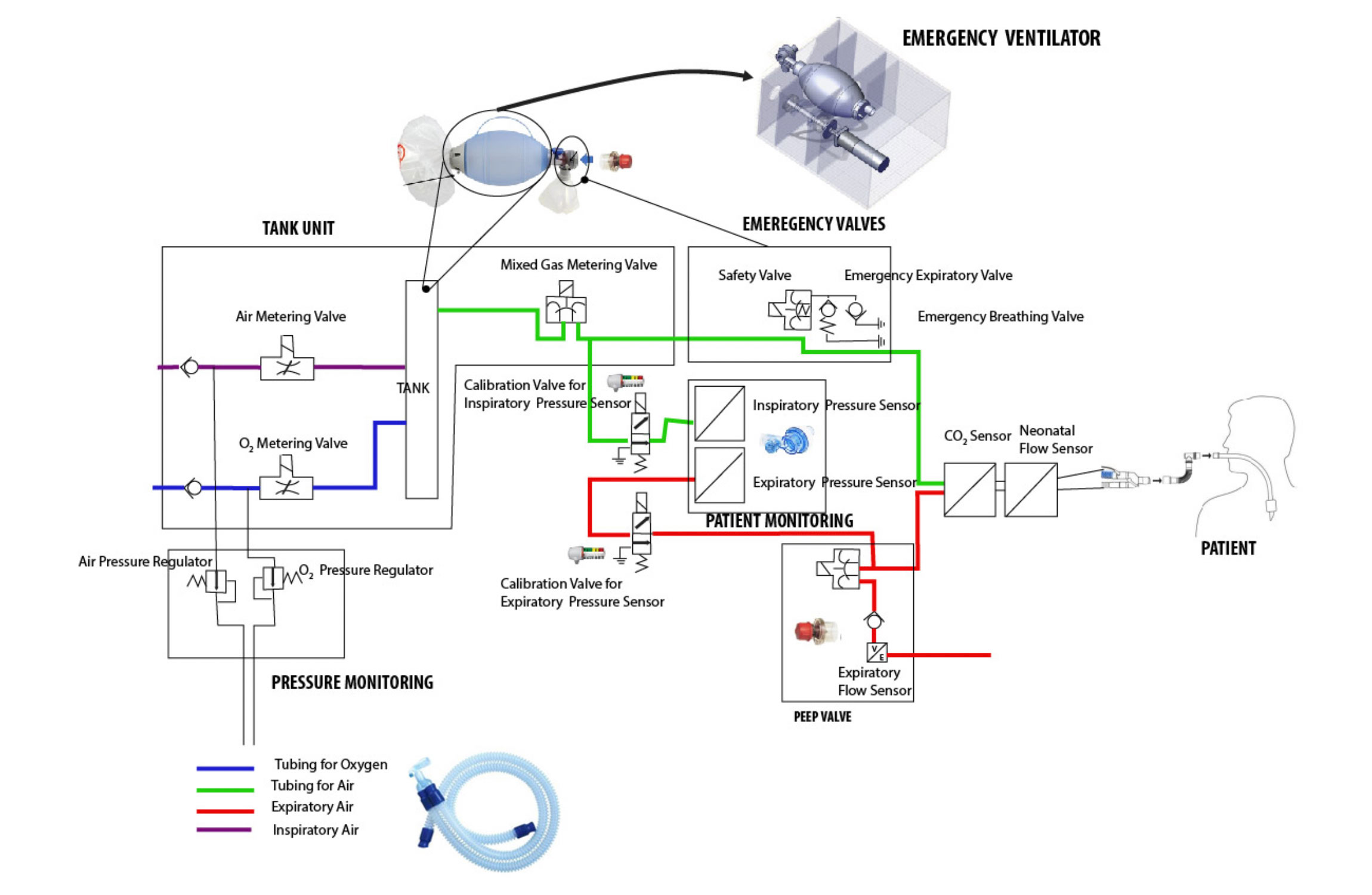 Development of an Open Design Low Cost Ventilator 